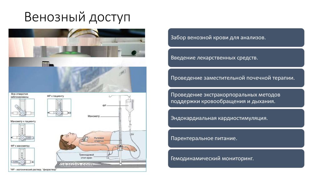 Венозный доступ презентация