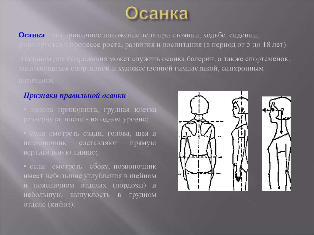 Осанка. Нарушение осанки. Один из видов нарушений осанки.. 2) Выявление нарушений осанки.. Коррекция нарушения осанки.