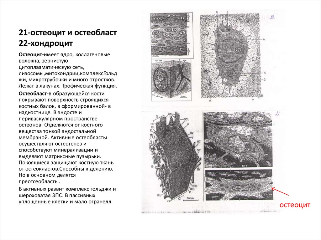 Остеоцит. Остеоциты гистология строение. Клетки костной ткани: a) эпителиоциты b) хондроциты c) остеоциты. Пластинчатая костная ткань Электронограмма. Электронограммы клеток костной ткани.