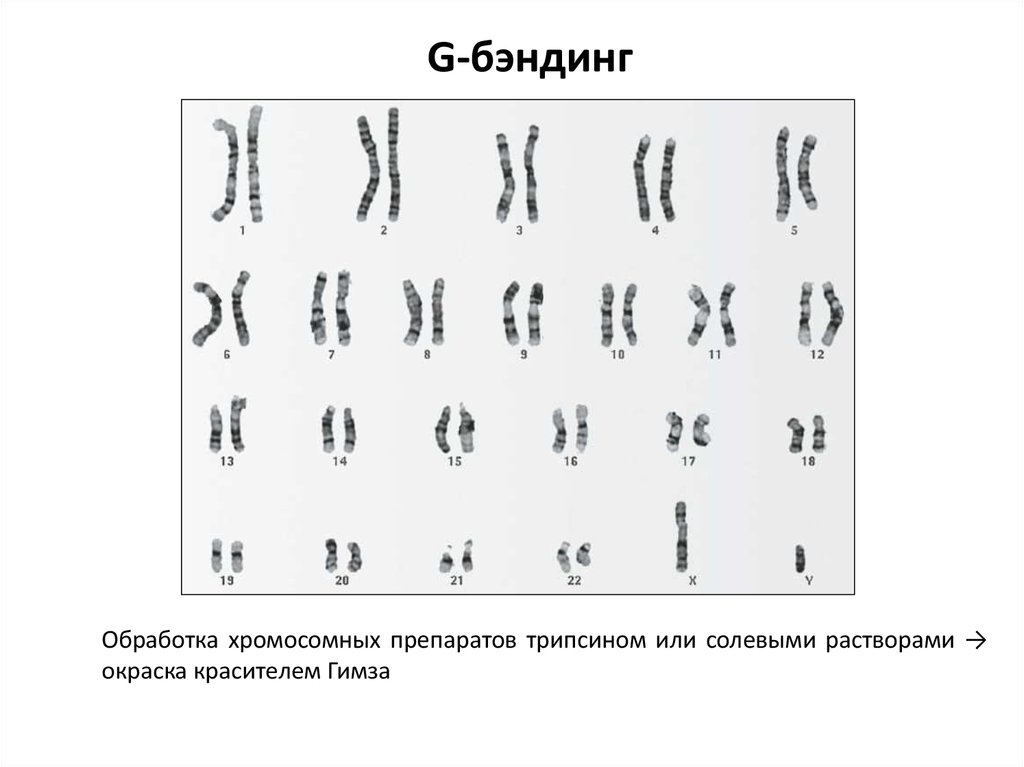 Хромосомный набор клеток листа. Дифференциальная окраска хромосом. Гимза окраска хромосом. Дифференцированная окраска хромосом. Кариотип человека дифференциальная окраска.