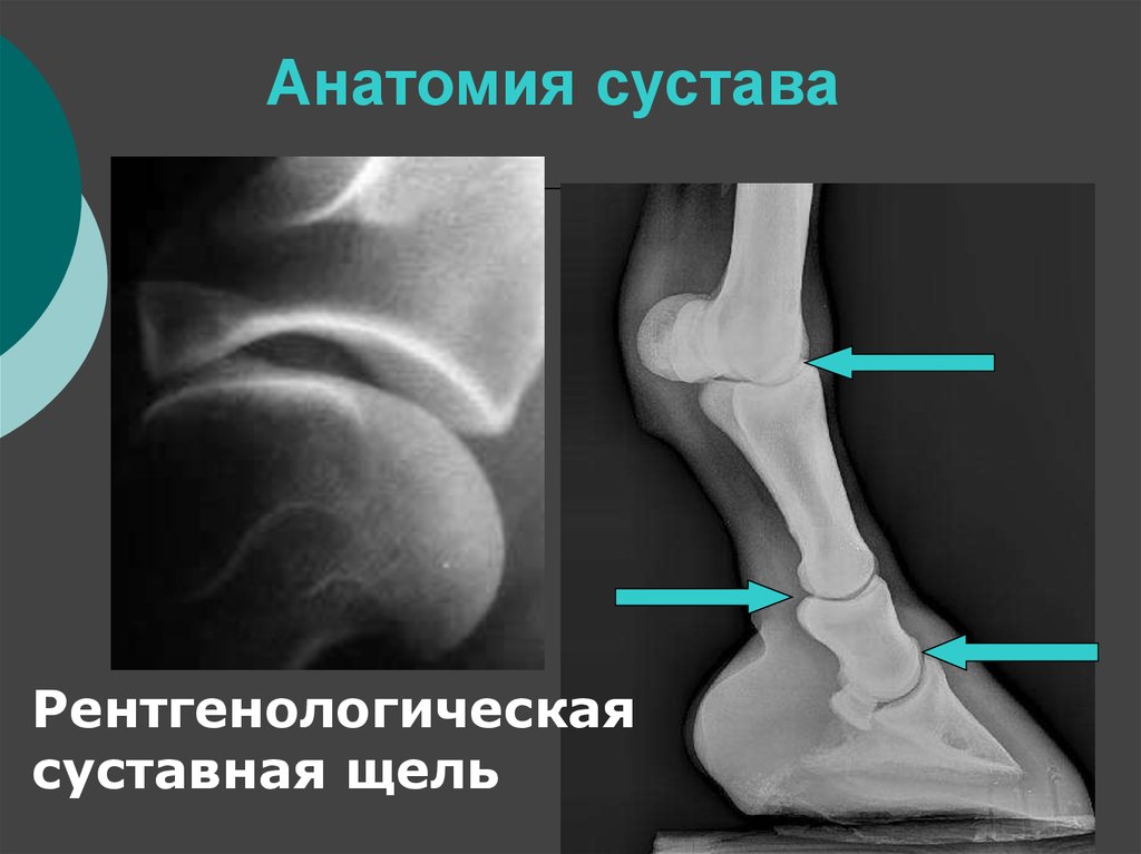 Суставная щель голеностопного сустава. Анатомическая суставная щель. Коленный сустав рентген анатомия. Коленная суставная щель патологии.