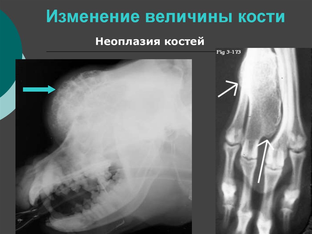 Изменение формы костей. Изменение положения формы величины костей. Аномалия костных структур что такое. Изменение формы кости