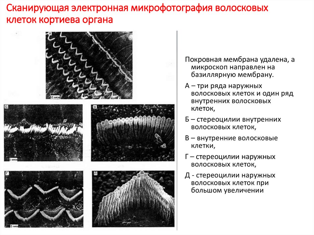 Сканирующая электронная микрофотография волосковых клеток кортиева органа