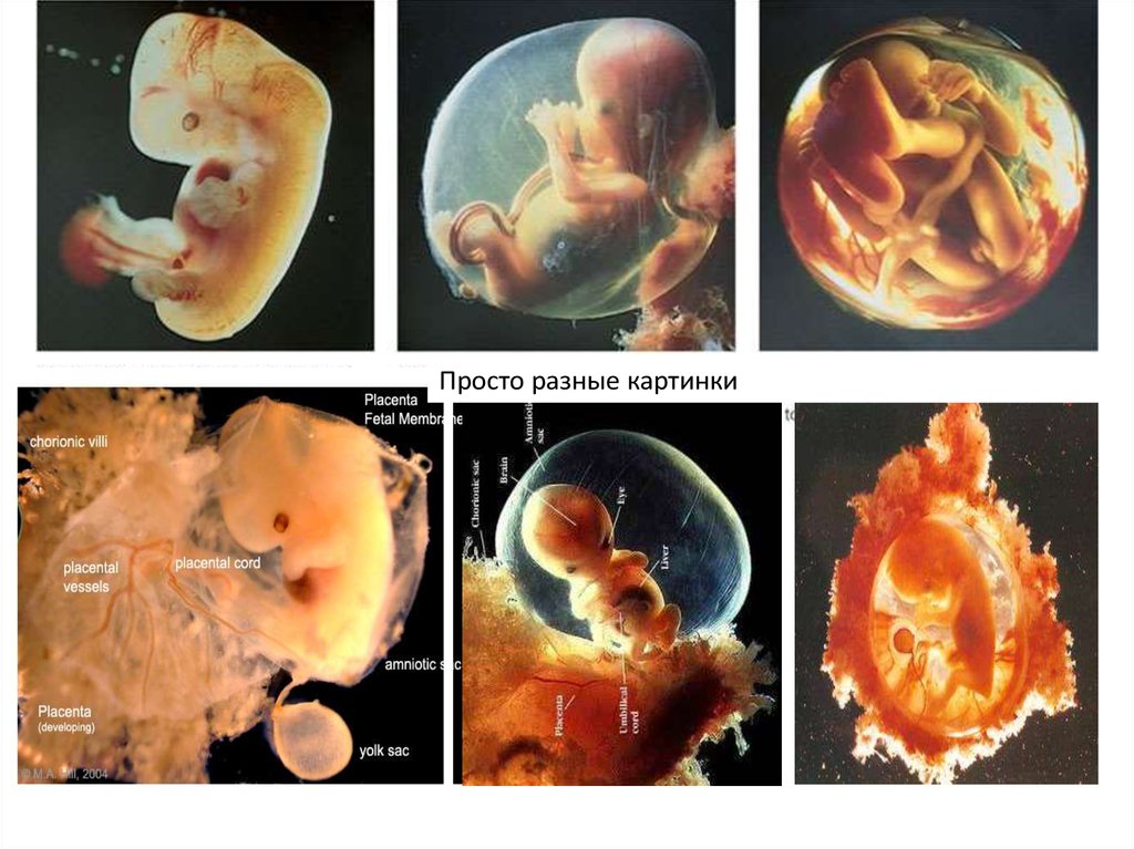 Ранние эмбрионы. Эмбриональное развитие человека. Органогенез плода по неделям. Формирование плода по дням с момента зачатия.
