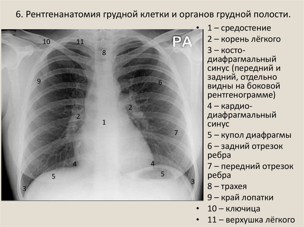 Округлыми формами в легком. Передняя проекция грудной клетки рентген. Рентгеноанатомия органов грудной клетки. Рентген грудной клетки в боковой проекции норма.