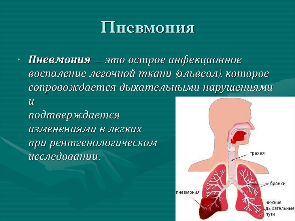Патологии дыхательных путей