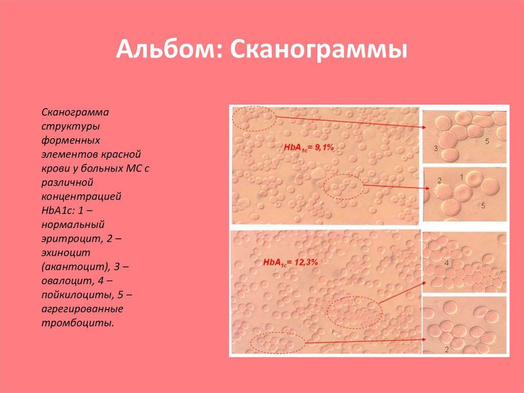 Альбом: Сканограммы