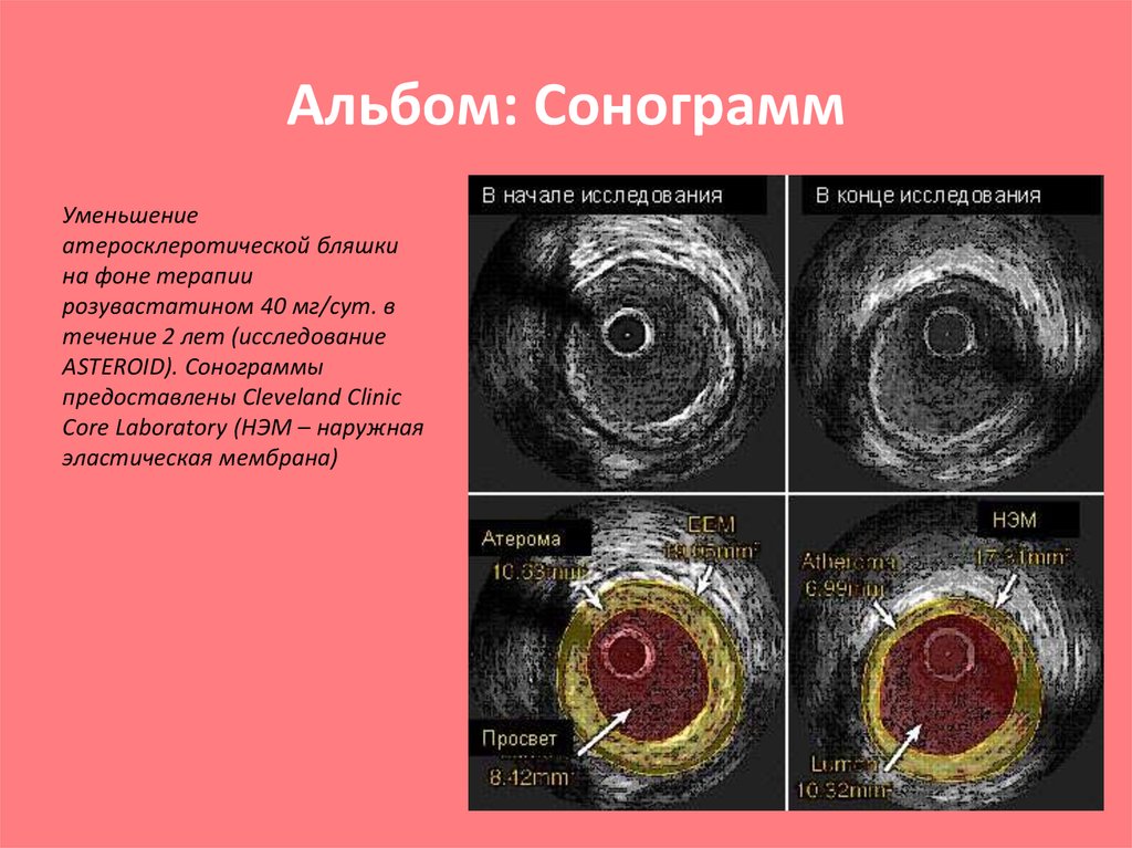 Альбом: Сонограмм