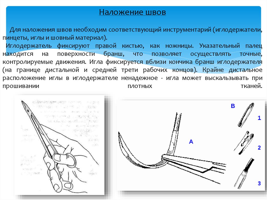 Хирургические швы презентация