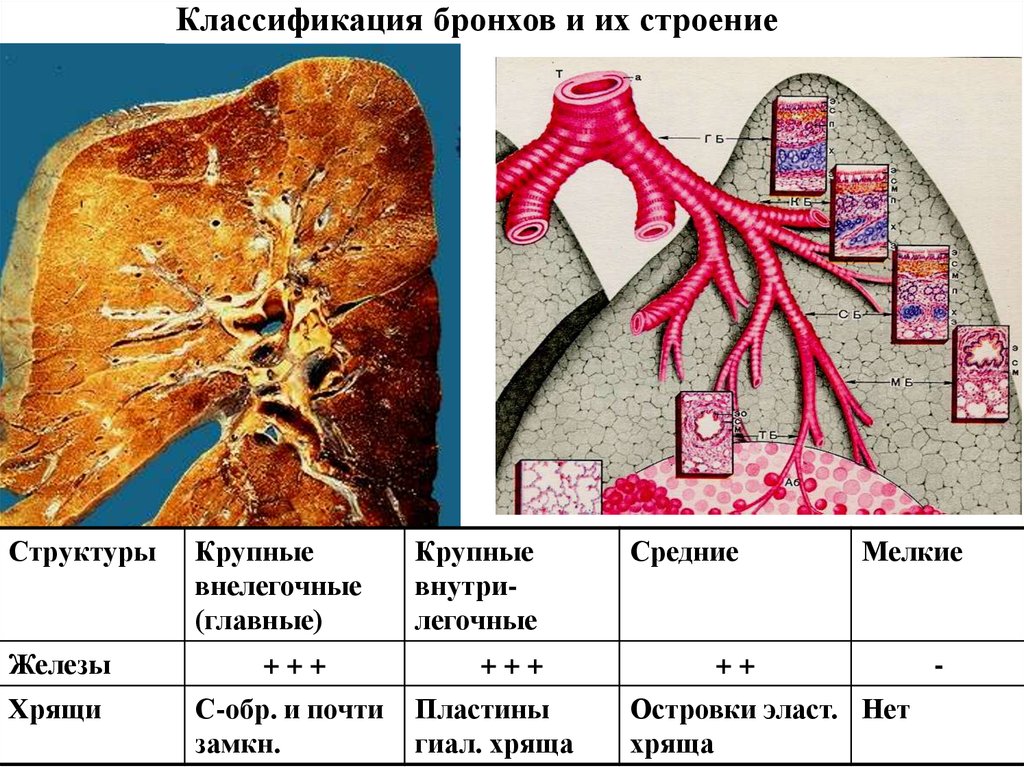 Строение крупно. Послойное строение бронхов. Бронхи препарат анатомия. Железы внутрилегочных бронхов. Классификация бронхов гистология.