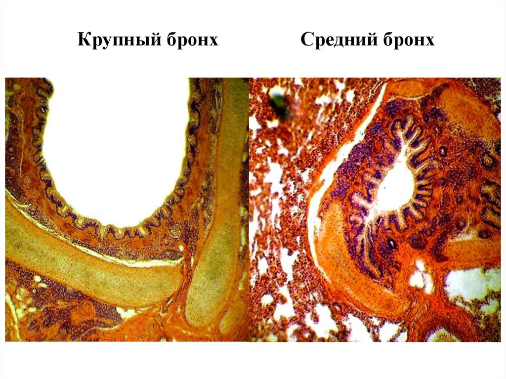 Эпителий крупных и средних бронхов