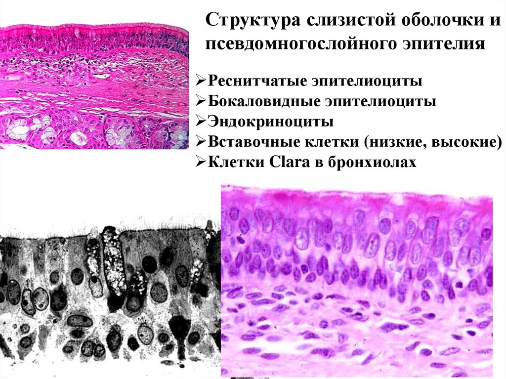 Эпителиоциты. Мерцательный эпителий гистология. Мерцательный эпителий слизистой оболочки. Эпителий слизистой оболочки респираторных бронхиол. Псевдомногослойный эпителий.