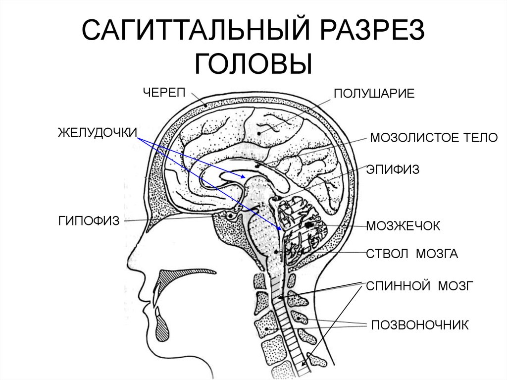 В полости черепа расположен. Анатомия головы человека мозжечок. Сагиттальный распил головного мозга анатомия. Среднесагиттальный разрез головы человека. Сагиттальный разрез головы анатомия человека.