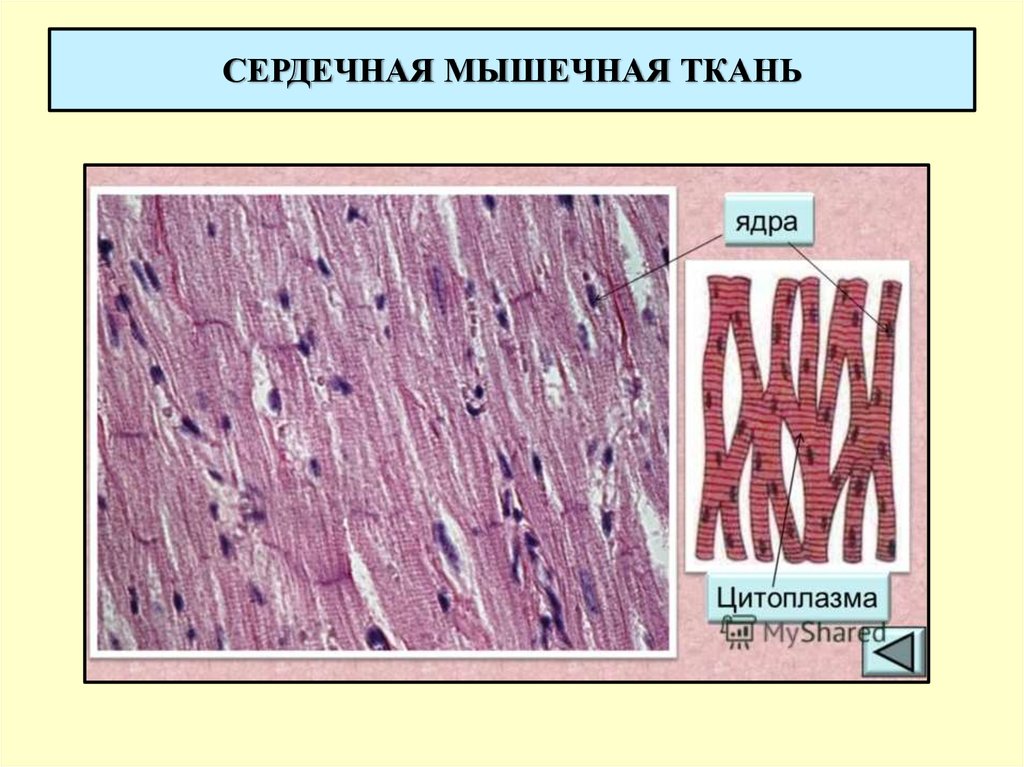 Поперечно полосатая сердечная мышечная ткань гистология рисунок