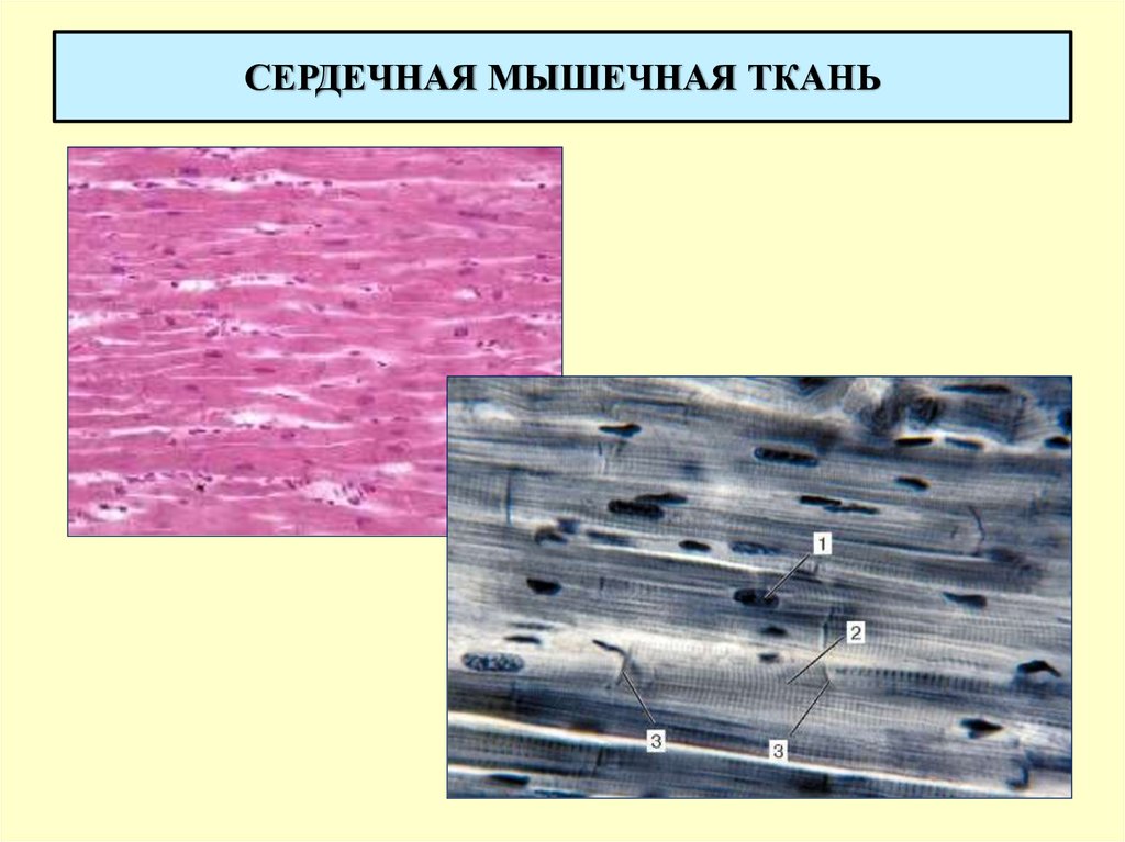 Изображение поперечно полосатой мышечной ткани. Поперечно сердечная мышечная ткань строение. Поперечно мышечная ткань гистология. Поперечнополосатая сердечная мышечная ткань препарат. Поперечно полосатая сердечная ткань гистология.