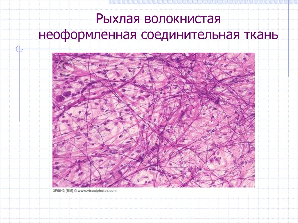 Плотная волокнистая неоформленная соединительная ткань рисунок