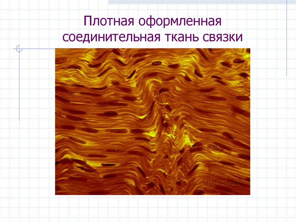 Соединительная 2. Плотная оформленная эластическая соединительная ткань. Плотная соединительная ткань связки. Плотная оформленная соединительная ткань выйная связка. Плотная оформленная соед ткань связка.