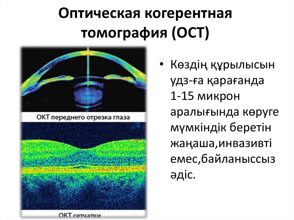 Оптическая когерентная томография схема