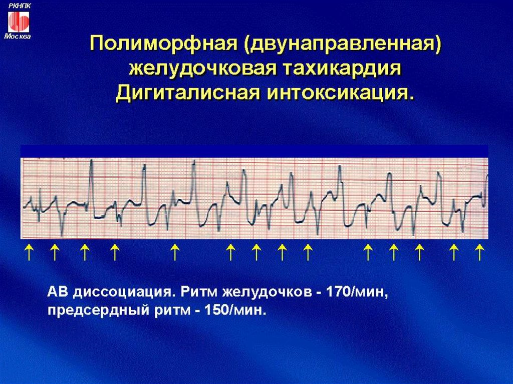 Жт типа пируэт картинки