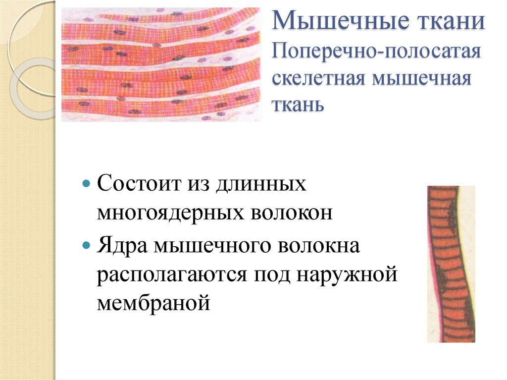 Изображение поперечно полосатой мышечной ткани. Поперечнополосатая мышечная ткань. Поперечно-полосатая Скелетная мышечная ткань. Поперечнополосатая Скелетная мышечная ткань. . Поперечнополосатая Скелетная мышечная ткань клетки.