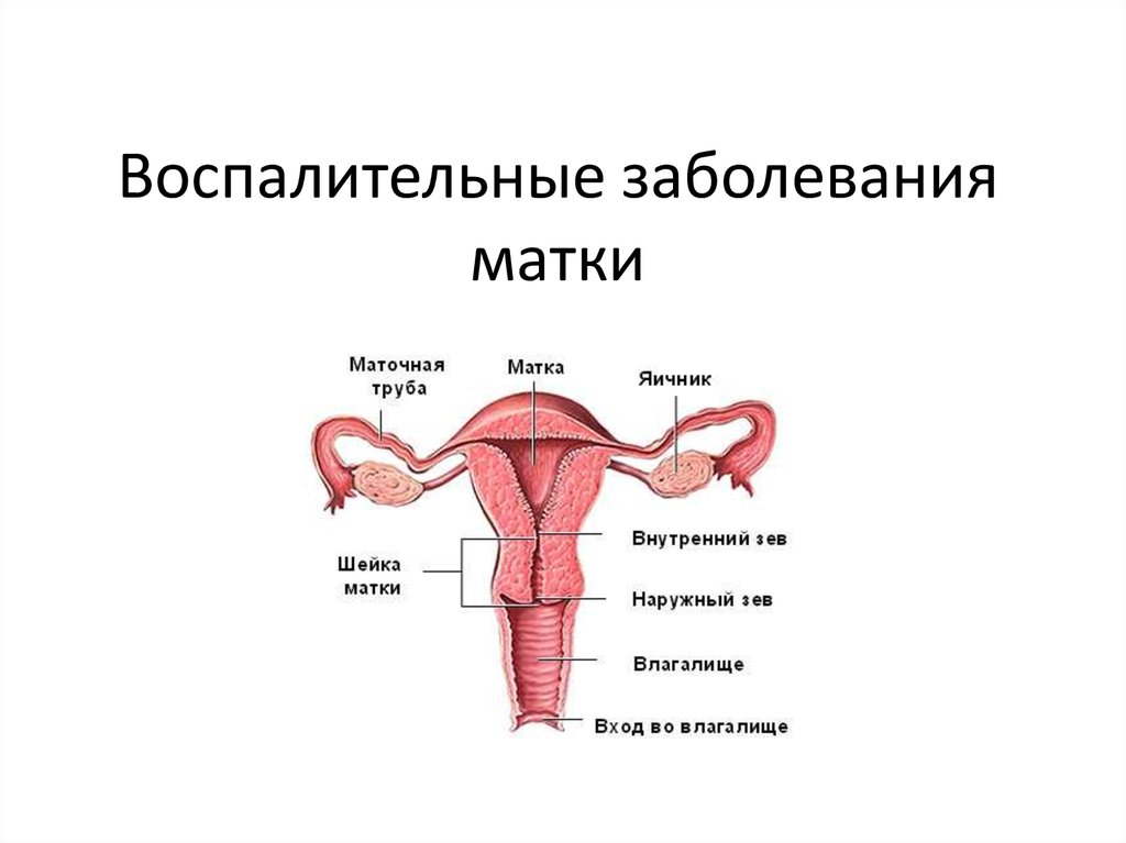 Анатомия матки презентация