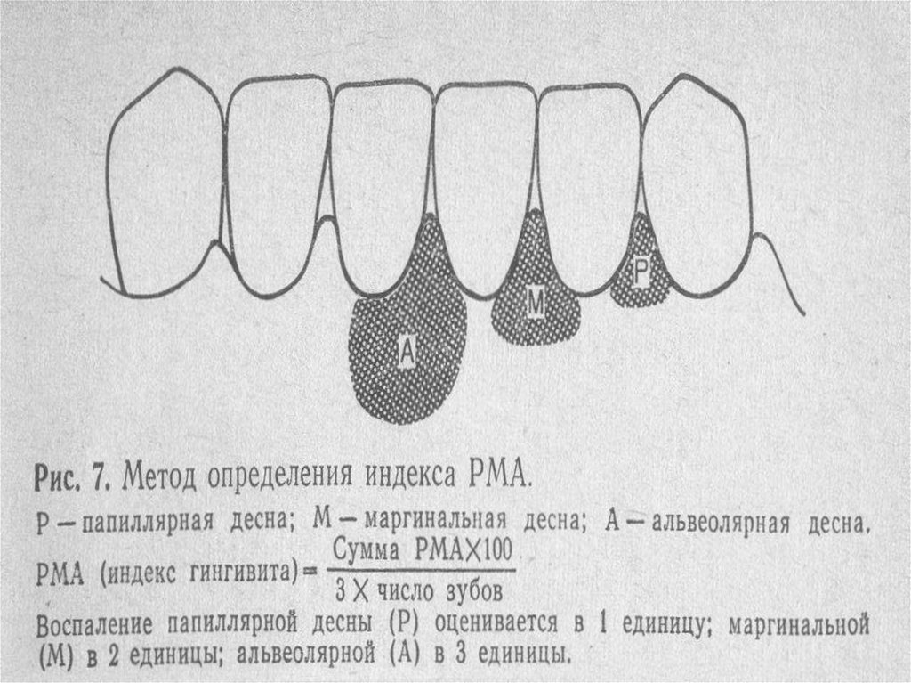 Оценка пародонта