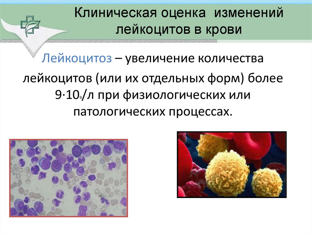 Высокие лейкоциты в крови у мужчины