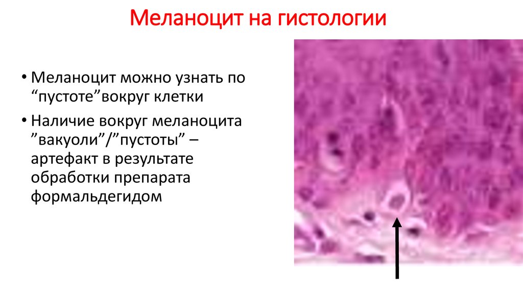 Рниму гистология презентации