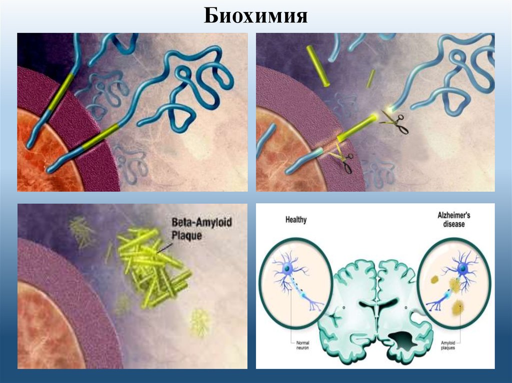 Белок альцгеймера