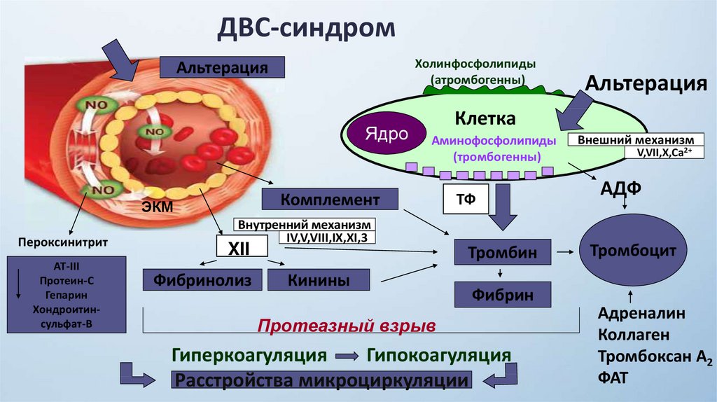 Схема двс синдрома