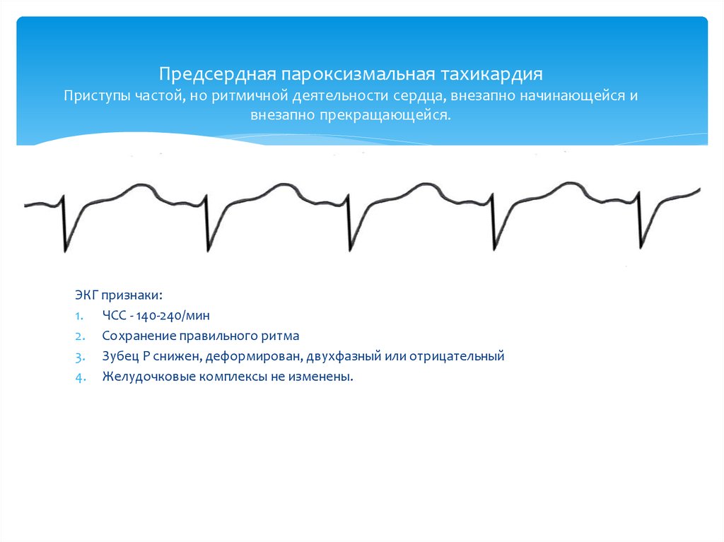 Тахикардия осложнения