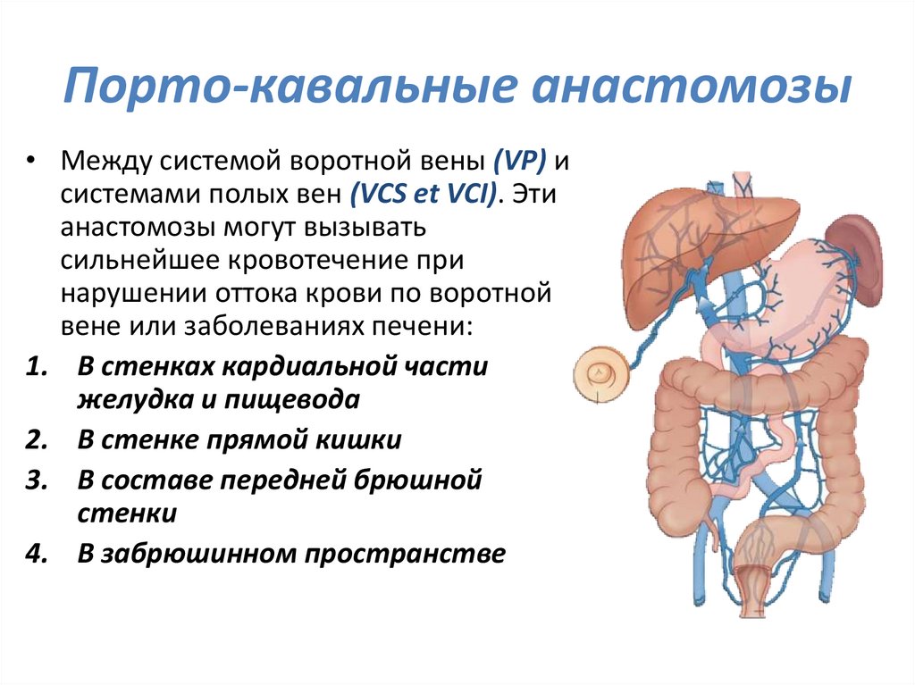 Порто кавальные анастомозы