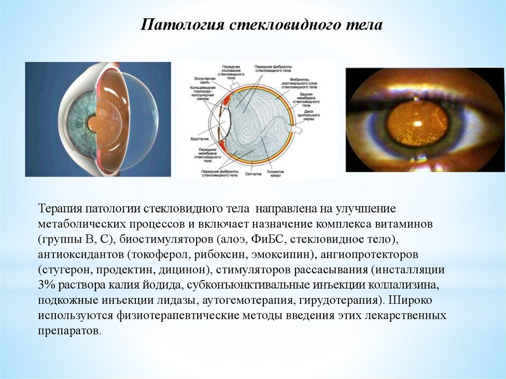 Стекловидное тело это