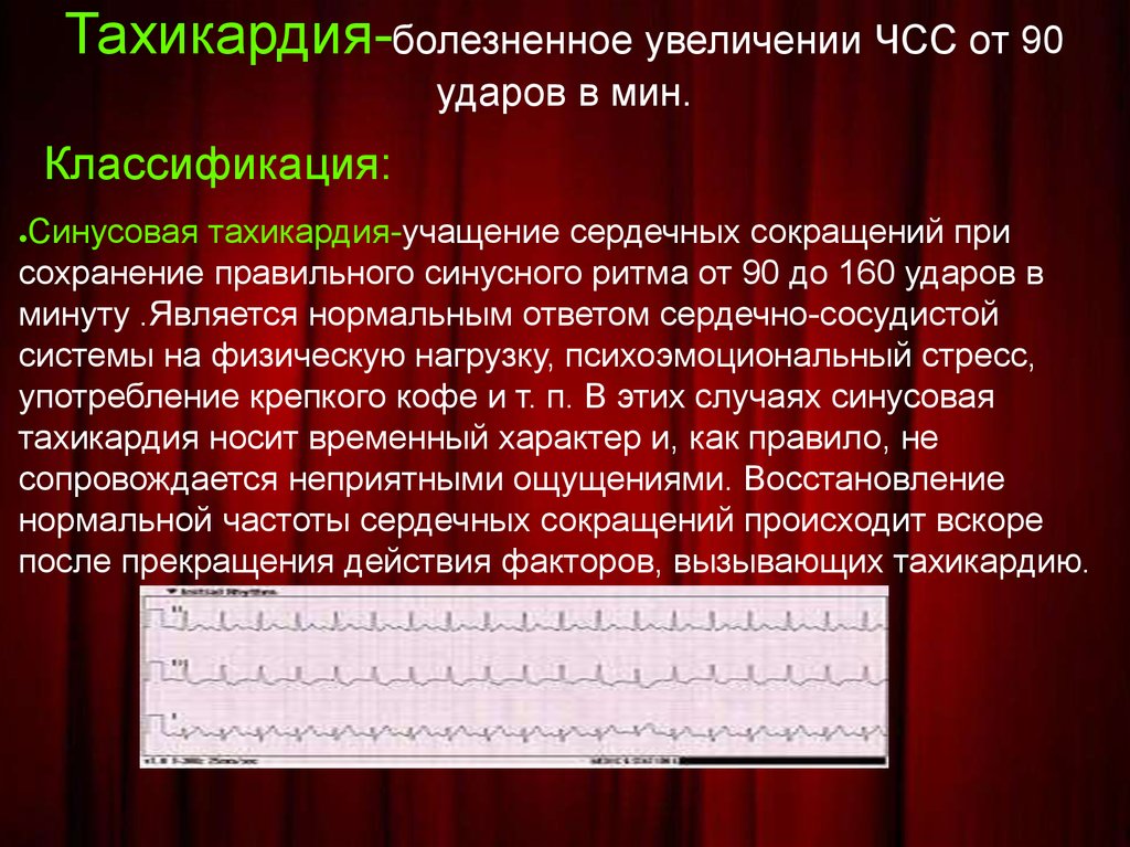 Чсс 98 в минуту. Брадикардия классификация. При брадикардии частота сердечных сокращений. ЧСС брадикардия. Частота пульса при брадикардии.