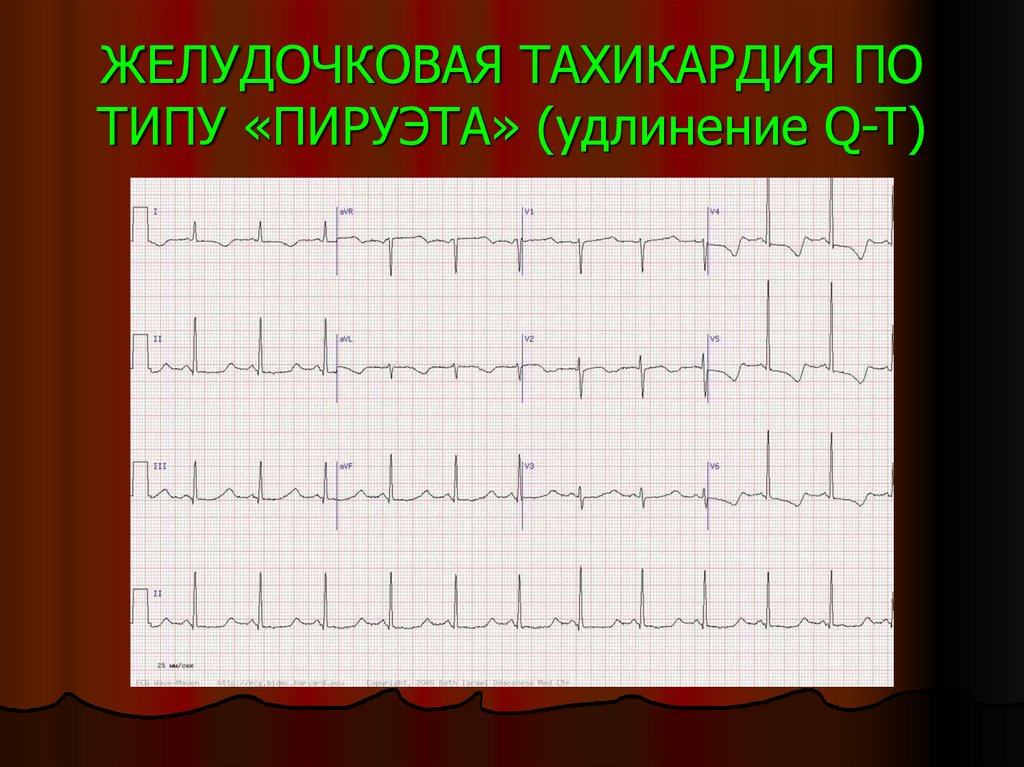 Жт типа пируэт картинки