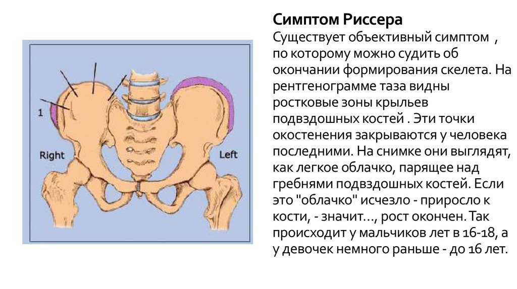 Костный мозг подвздошной кости
