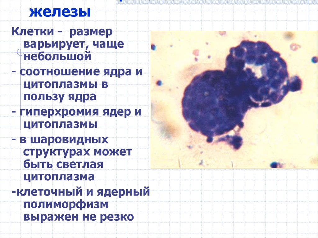 Выпотные жидкости презентация