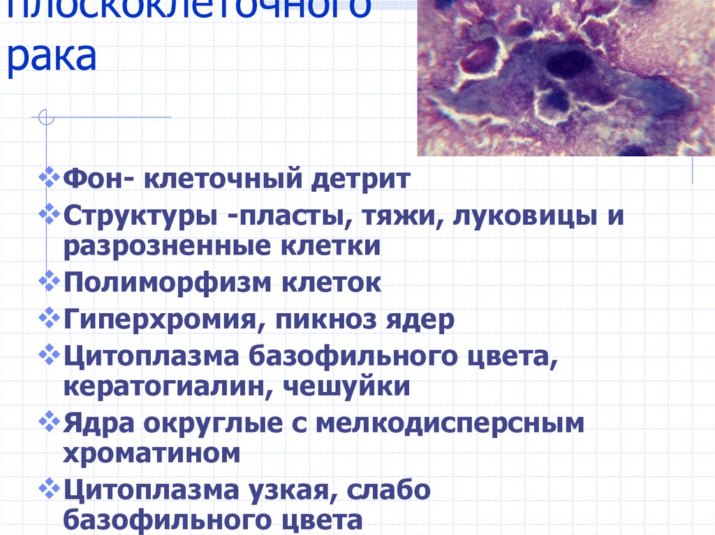 Выпотные жидкости презентация