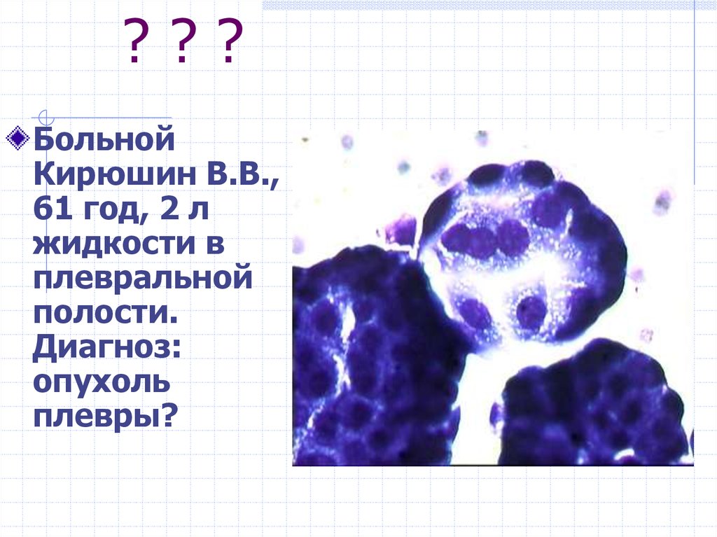 Выпотные жидкости презентация