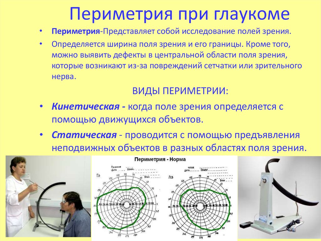 Полем зрения называется. Периметрия поля зрения норма. Расшифровка компьютерной периметрии глаза. Исследование полей зрения периметрия норма. Расшифровка компьютерной периметрии полей зрения.