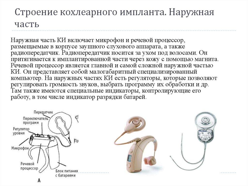 Кохлеарные импланты используют. 17-01-01 Слуховой аппарат аналоговый заушный сверхмощный. Речевой процессор к кохлеарному импланту цена. Речевой процессор классификация. Речевой процессор письмо.