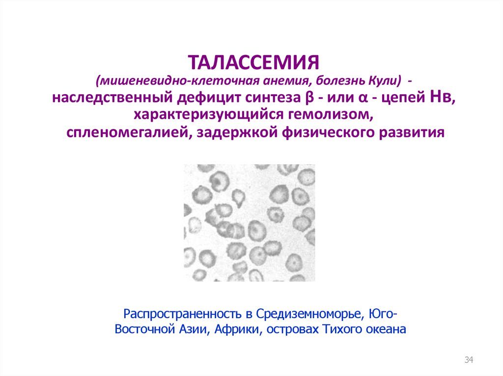 Талассемия что это. Талассемия гипохромная анемия. Талассемия анемия патогенез. Β-талассемия характеризуется:.