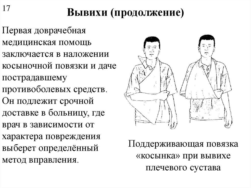 Первая помощь при вывихе. Вывих доврачебная помощь. Вывих первая доврачебная помощь. Первая медицинская и доврачебная помощь при вывихах. ПМП при вывихе плечевого сустава.