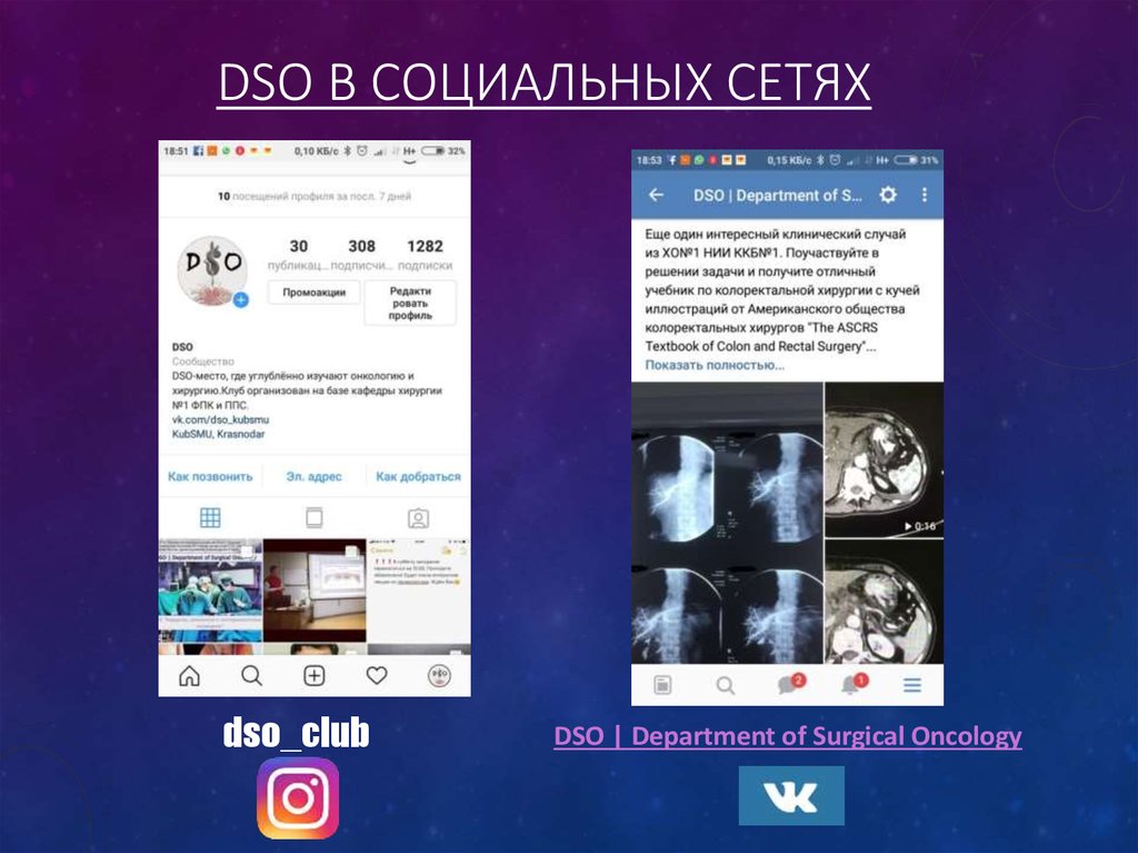 DSO в социальных сетях