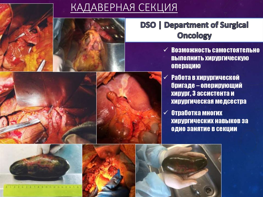 Кадаверная секция