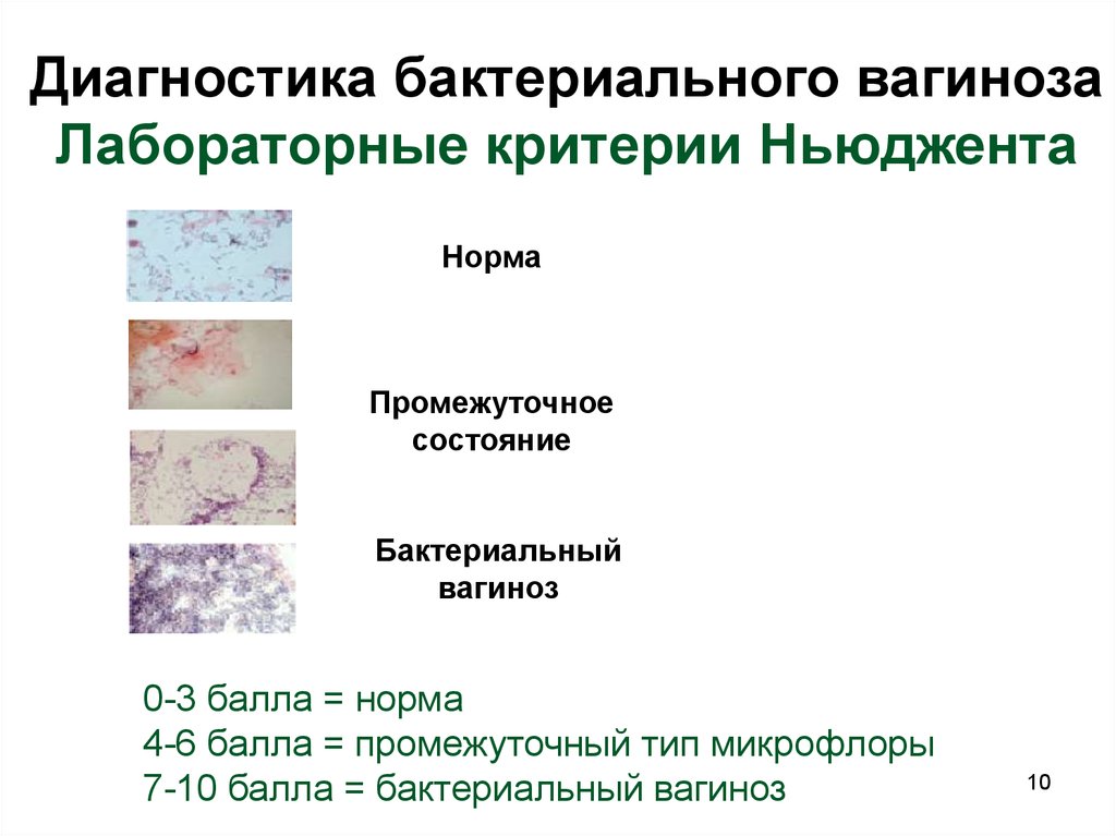 Причины бактериального. Бактериальный вагиноз микропрепарат. Картина мазка при бактериальном вагинозе. Бактериальный вагиноз микробиология. Бактериальный вагиноз лабораторная диагностика.