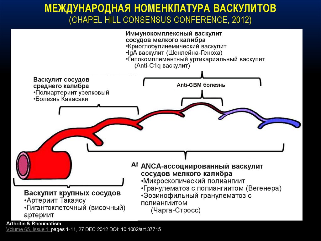 Васкулиты классификация диагностика симптомы. Классификация васкулитов Чапел-Хилл 2012. Системные васкулиты классификация. Классификация системных васкулитов Chapel Hill 2012. Системные васкулиты у детей классификация.