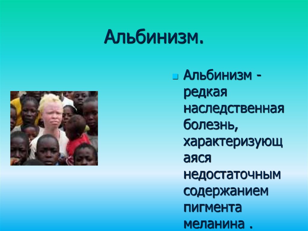 Альбинизм биохимия. Профилактика альбинизма. Альбинизм презентация.