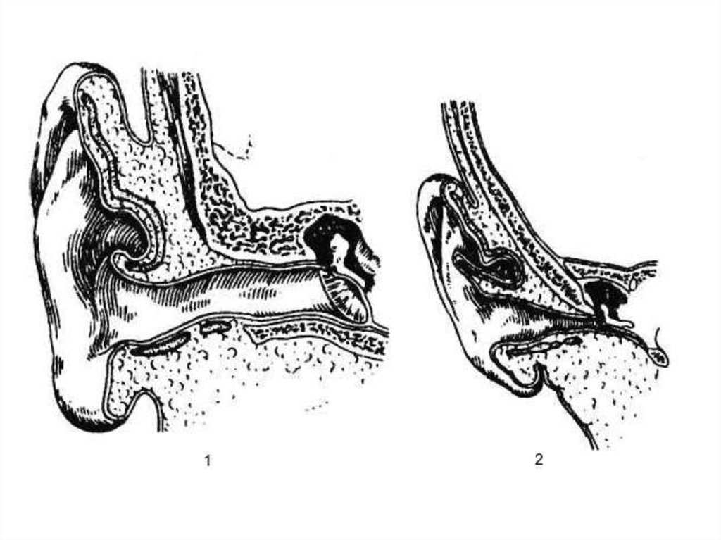 Воздух заполняет наружное ухо. Анатомия и физиология наружного уха. Топография слухового прохода. Физиология наружного слухового прохода. Физиология ушной раковины.