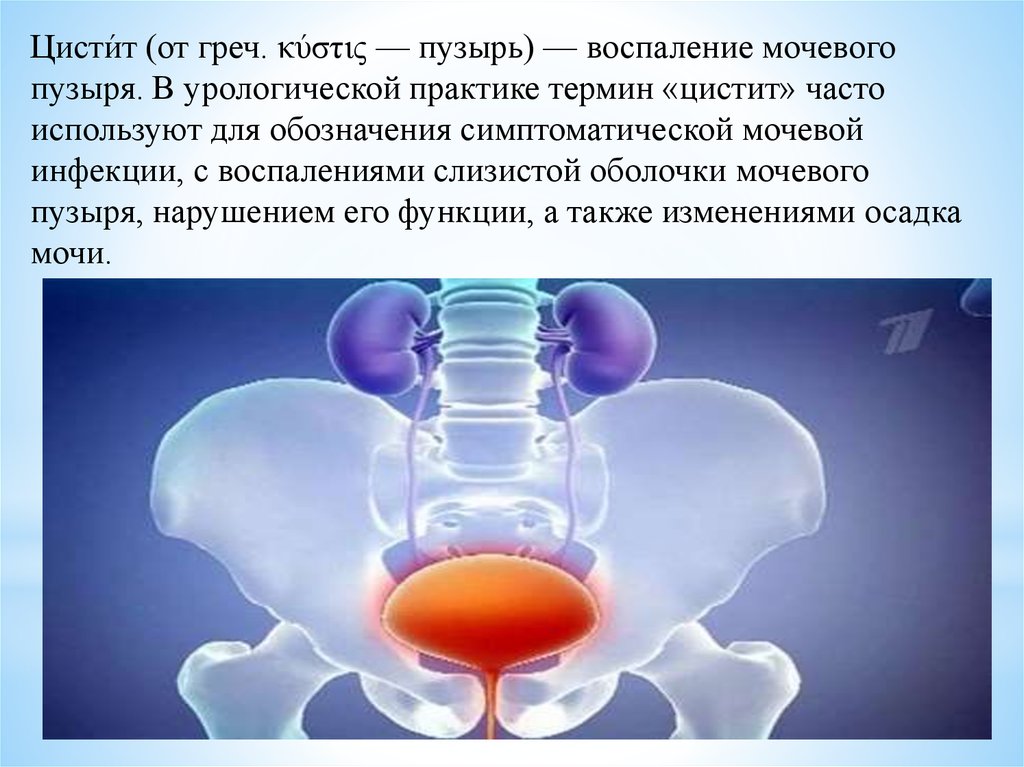 Воспаление мочевого пузыря это. Воспаление слизистой оболочки мочевого пузыря. Цистит презентация урология. Цистит воспаление мочевого пузыря.